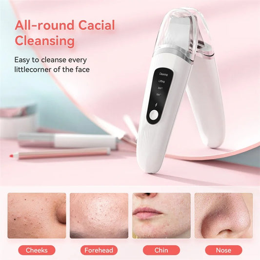 Ultrasonic Skin Scrubber| Skelblum
