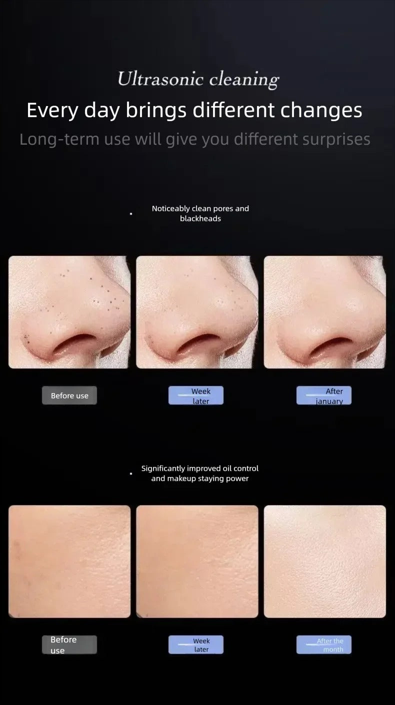 Ultrasonic Skin Scrubber