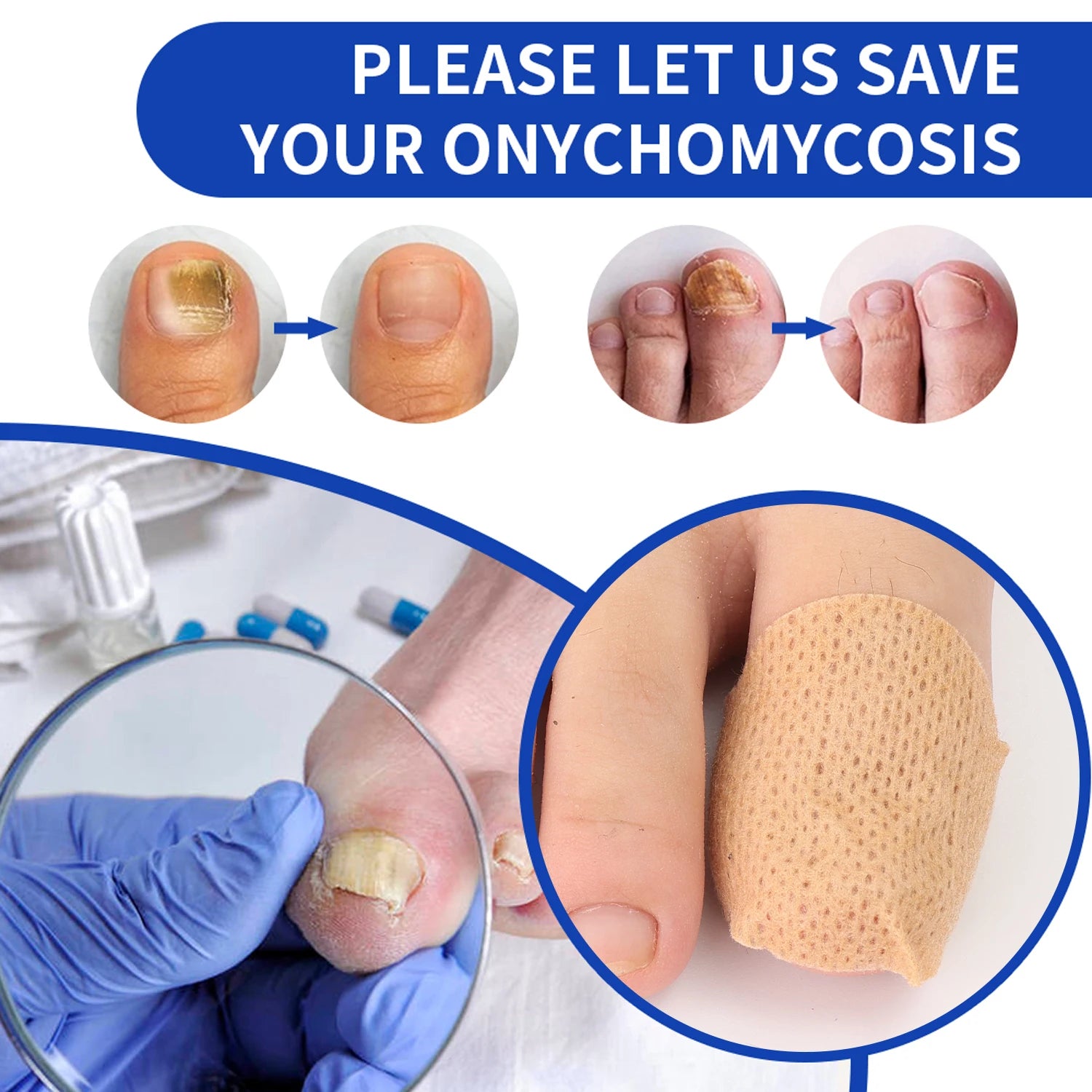 Toenail Repair Patches Set | Skelblum