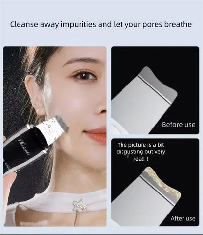 Ultrasonic Skin Scrubber